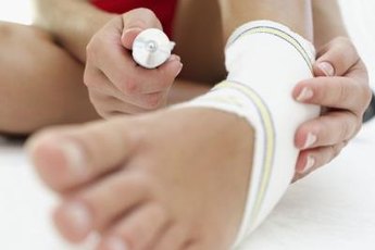 In 2012, the American Academy of Orthopaedic Surgeons estimated that 25,000 ankle injuries occur in the United States each day.