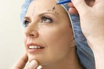 Plastic surgeons usually map out incisions to show patients what to expect.