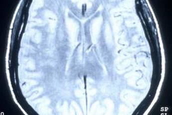 Evolutionary psychologists study how the brain has evolved over millions of years.