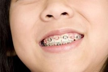 Orthodontic assistants often work with children.