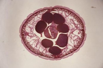 A roundworm is a type of nematode (a sort of worm).