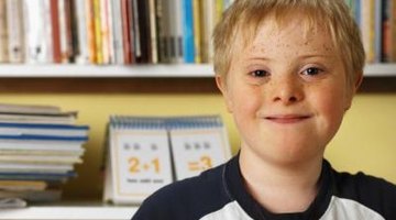 Intellectual disability is determined by the scores on standardized IQ and adaptive behavior scales.