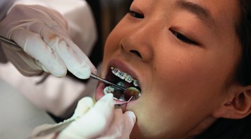 Orthodontics students learn the application of braces to correct tooth alignment.