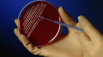 In a microbiology class, plating bacteria on agar can help to indentify bacterial species.