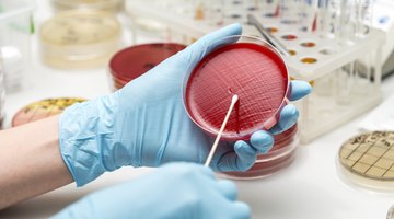 How to Identify an Unknown Bacteria in Microbiology