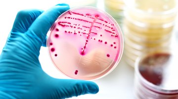What Three Conditions Are Ideal for Bacteria to Grow?