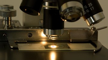 Your doctor can look at a skin scrape sample to diagnose ringworm.