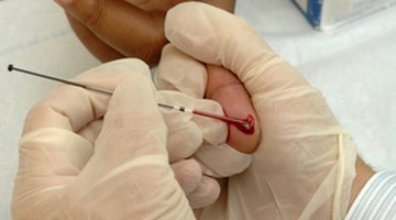Abreviaturas comunes usadas en los análisis de sangre 