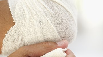 Cómo quitar el vendaje de una herida sin dolor
