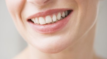 Dental Work on Teen - Teeth Polishing