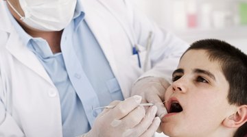 Extracción de dientes en niños