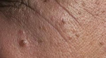 Pollution can lead to premature skin ageing.