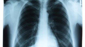 Air pollution can cause chest pains.