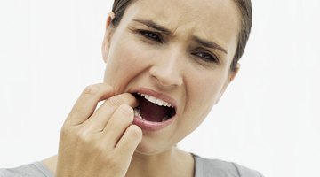 Cómo deshacerte de los herpes labiales con quitaesmalte