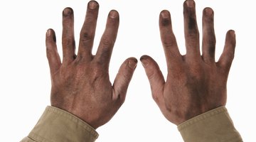 Cómo limpiar la piel sucia y agrietada de las manos