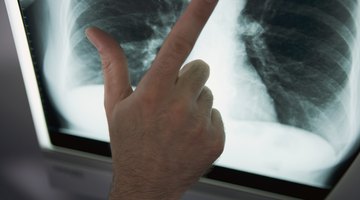 Diferencias entre pulmones sanos y enfermos