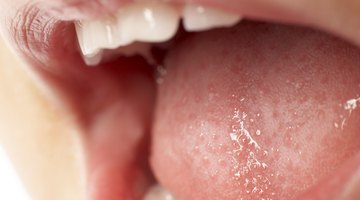 Los bultos dentro de tu boca pueden ser úlceras bucales, quistes mucosos, liquen plano oral o papilas inflamadas.