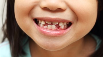 Close-Up Portrait of a Young Girl With Gappy Teeth