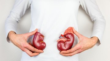 ¿Cuánto se tarda en pasar un cálculo renal?