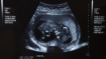 Pregnant woman watching baby on ultrasound scanner, elevated view