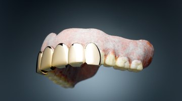 Cómo quitar las manchas de las prótesis dentales