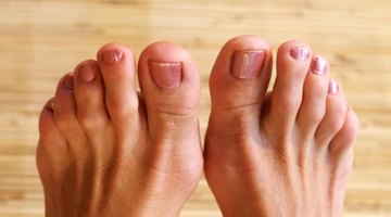 Cómo quitar el pellejo a un dedo del pie