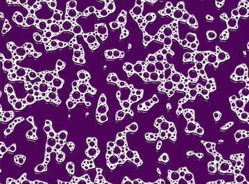 Gram-positive bacteria are stained violet.