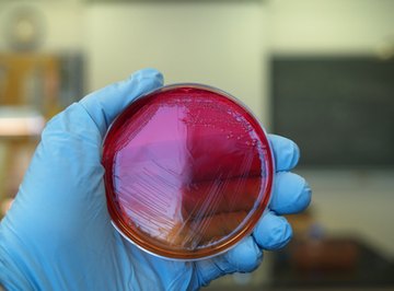 Colonies of bacteria growing in a petri dish