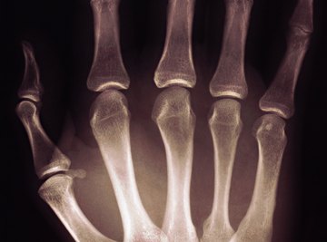 Students will be surprised to find that the lengths of finger bones approximate the Fibonacci sequence.