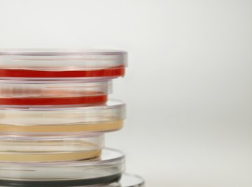 The Chemical Composition of Nutrient Agar