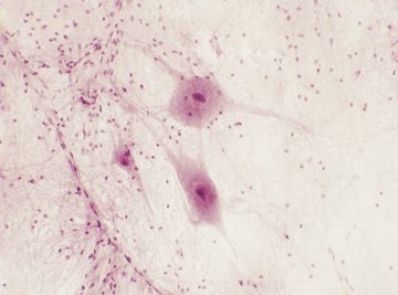 Neurons have small and large cytoplasmic extensions.
