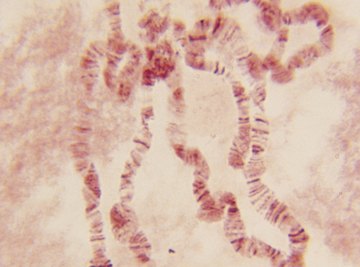 A chromosome contains a specific variation, or allele, of a gene.