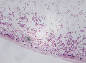 Prokaryotic cells are the same size as a mitochondria organelle in eukaryotic cells.