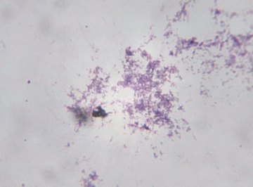 To see these bacteria in any further detail you'd need an oil immersion lens.