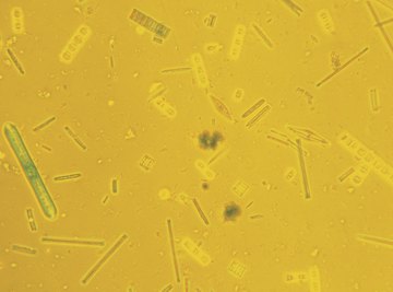 Diatoms are a crucial component of the ocean food web.