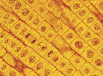 Cells in which chromosomes are not visible are in the interphase stage.