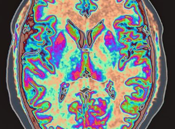 PET scans use radioactive isotopes to reveal the health of living tissues.