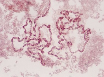 Chromosomes are arranged by pairs to be examined in a karyotype.