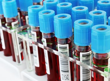 How Does Hemoglobin Show the Four Levels of Protein Structure?