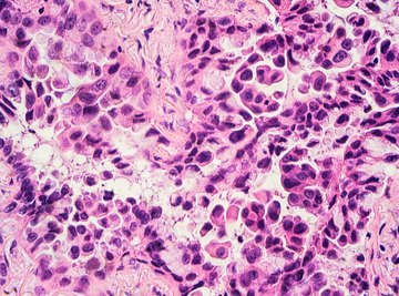 The Difference Between Anaphase, Interphase, Metaphase and Prophase