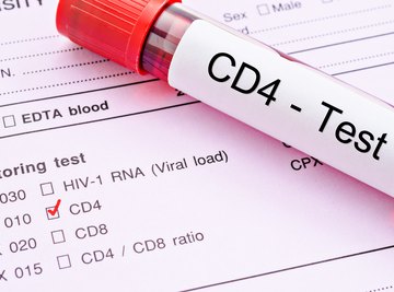 What Are the Advantages & Disadvantages of Flow Cytometry?