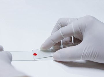 Similarities of Mitosis and Meiosis