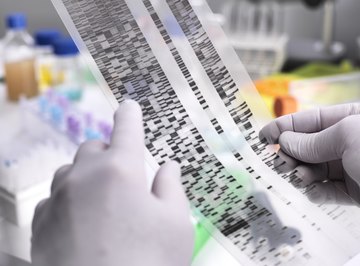 What Is the Difference Between Ribosome & Ribosomal DNA?