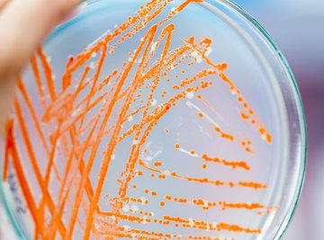 Types of Spore Forming Bacteria