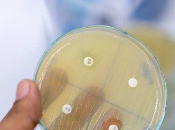 Three Mechanisms of Genetic Recombination in Prokaryotes