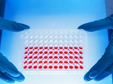 How Can a Mutation in DNA Affect Protein Synthesis