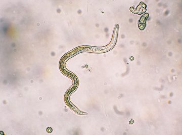 What Does a Roundworm Look Like?