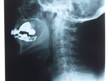 X-rays are penetrating radiation.