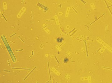 Diatoms have a unique, silica shell.