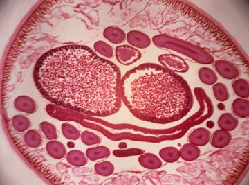 Nematodes, shown here in cross-section, have a simple body form, often referred to as a 